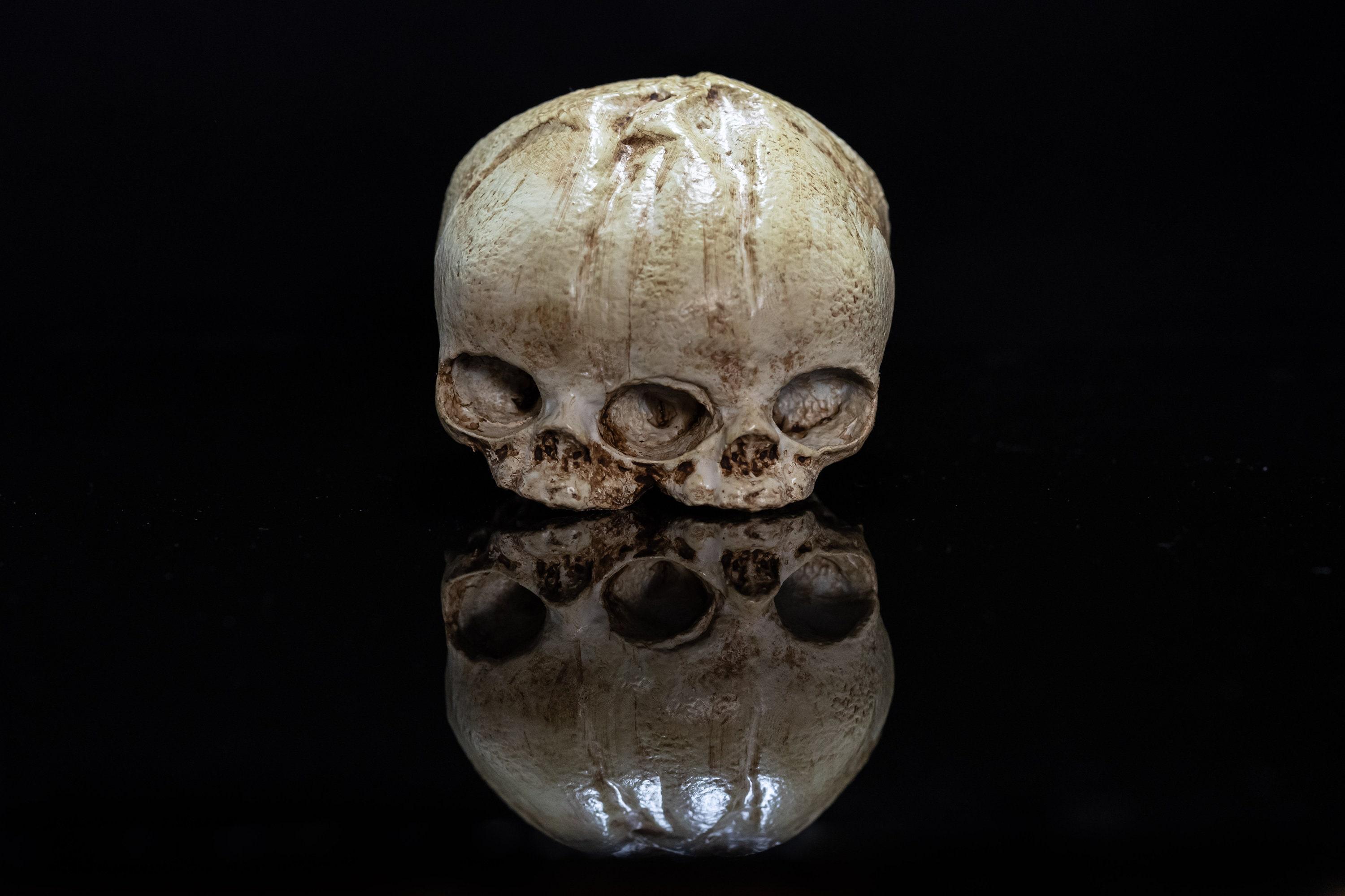 Conjoined Fetal Skull 3d model