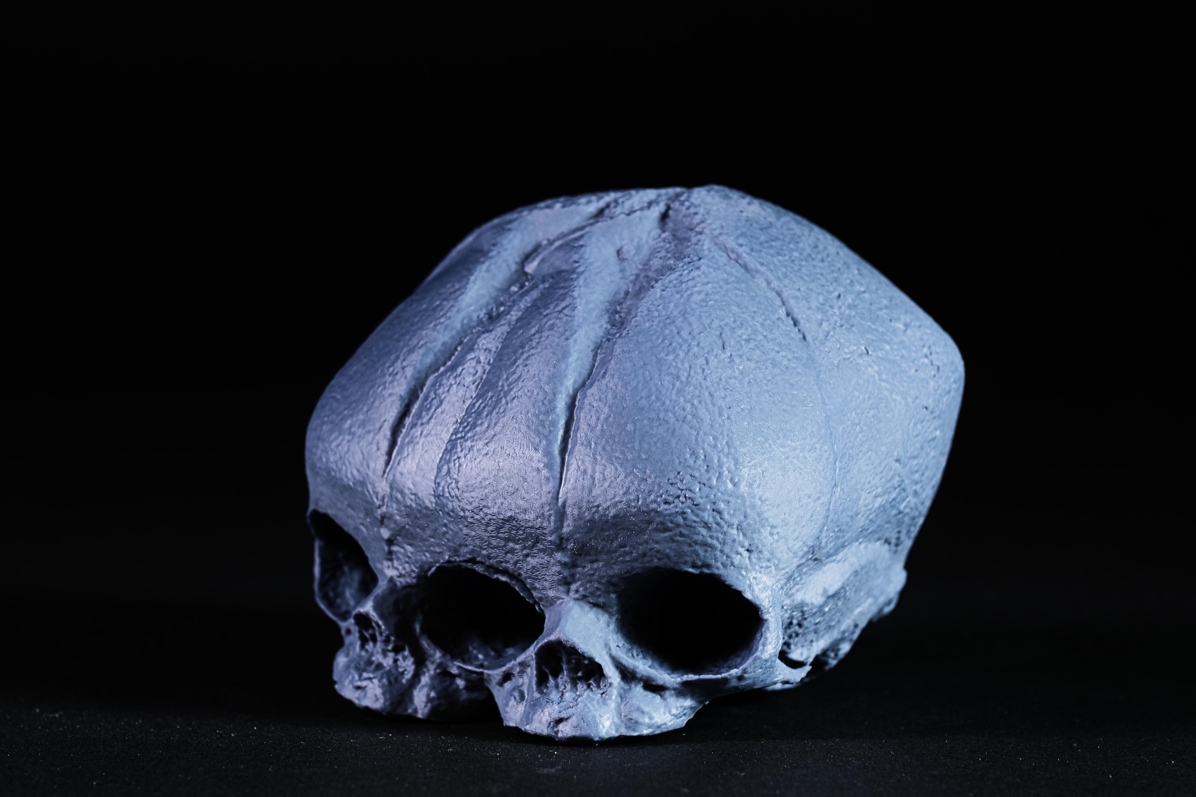 Conjoined Fetal Skull 3d model