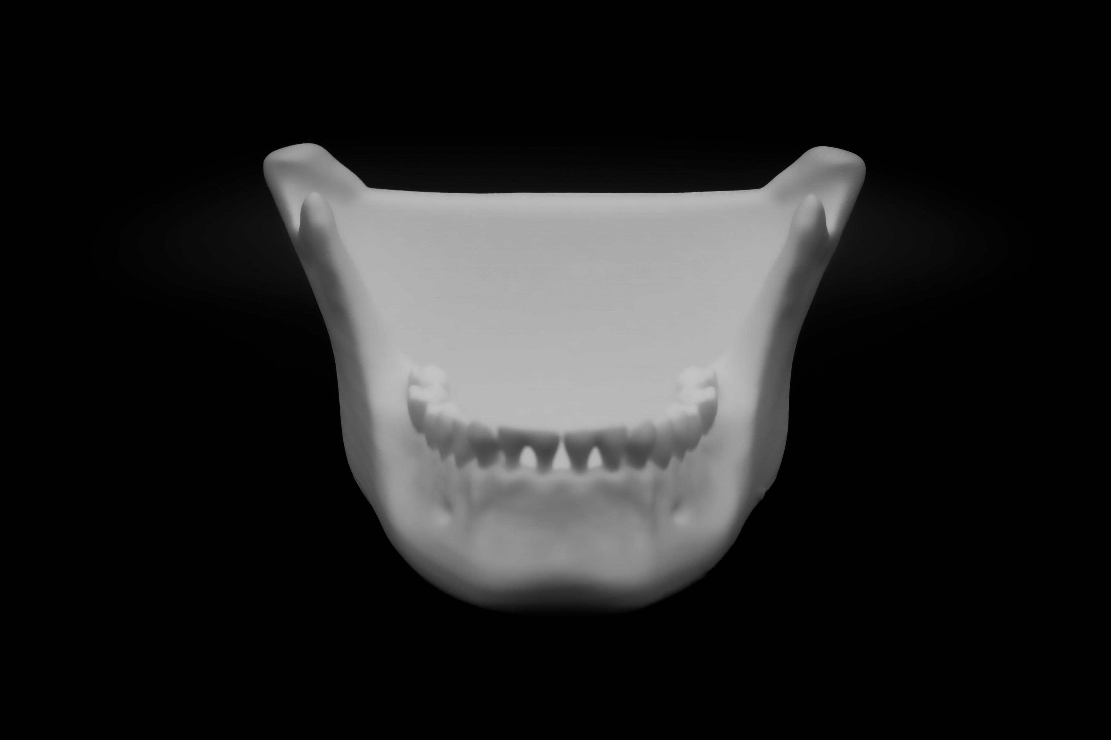 Human Jaw bowl (Pre Supported) 3d model