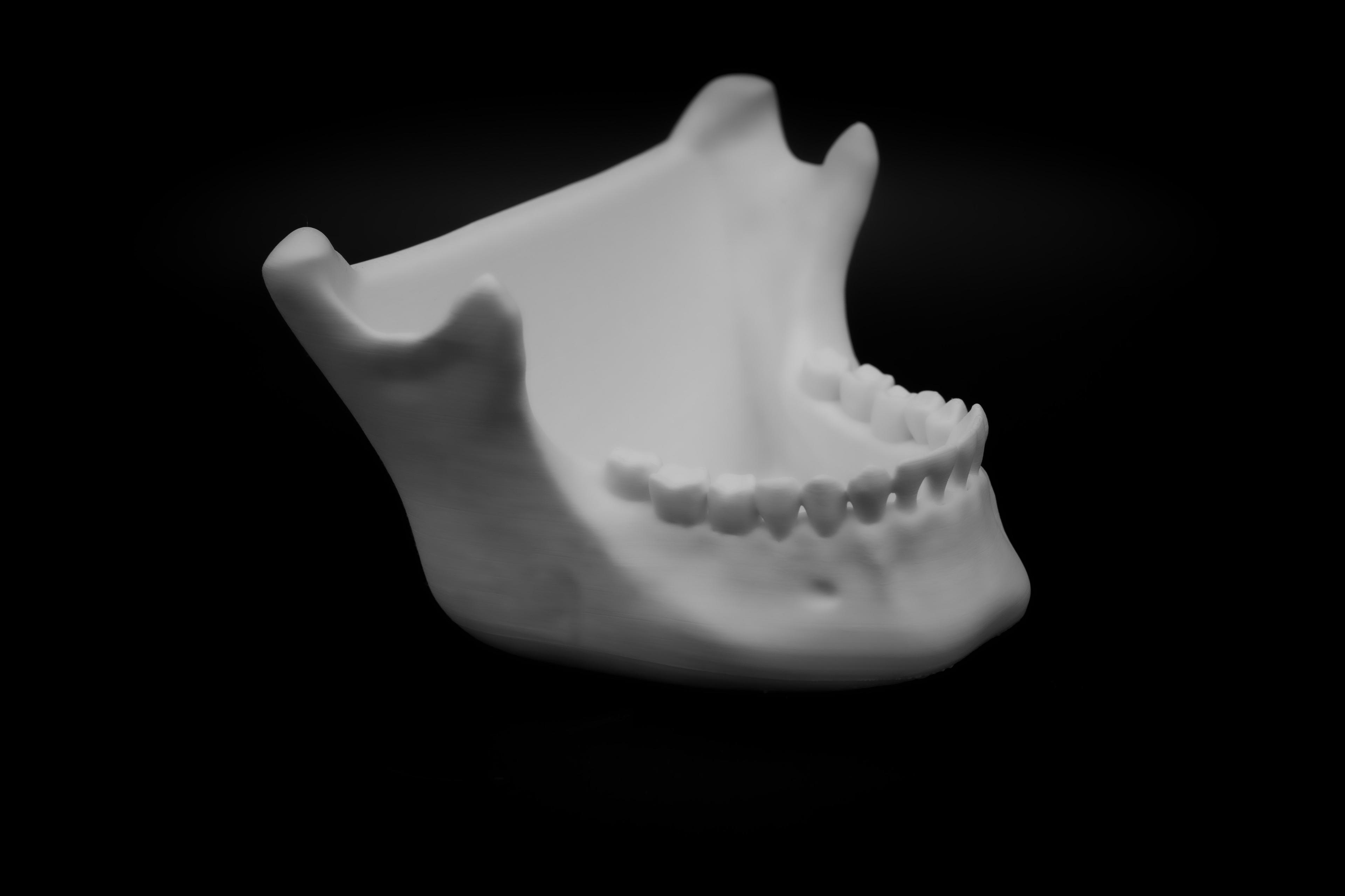 Human Jaw bowl (Pre Supported) 3d model