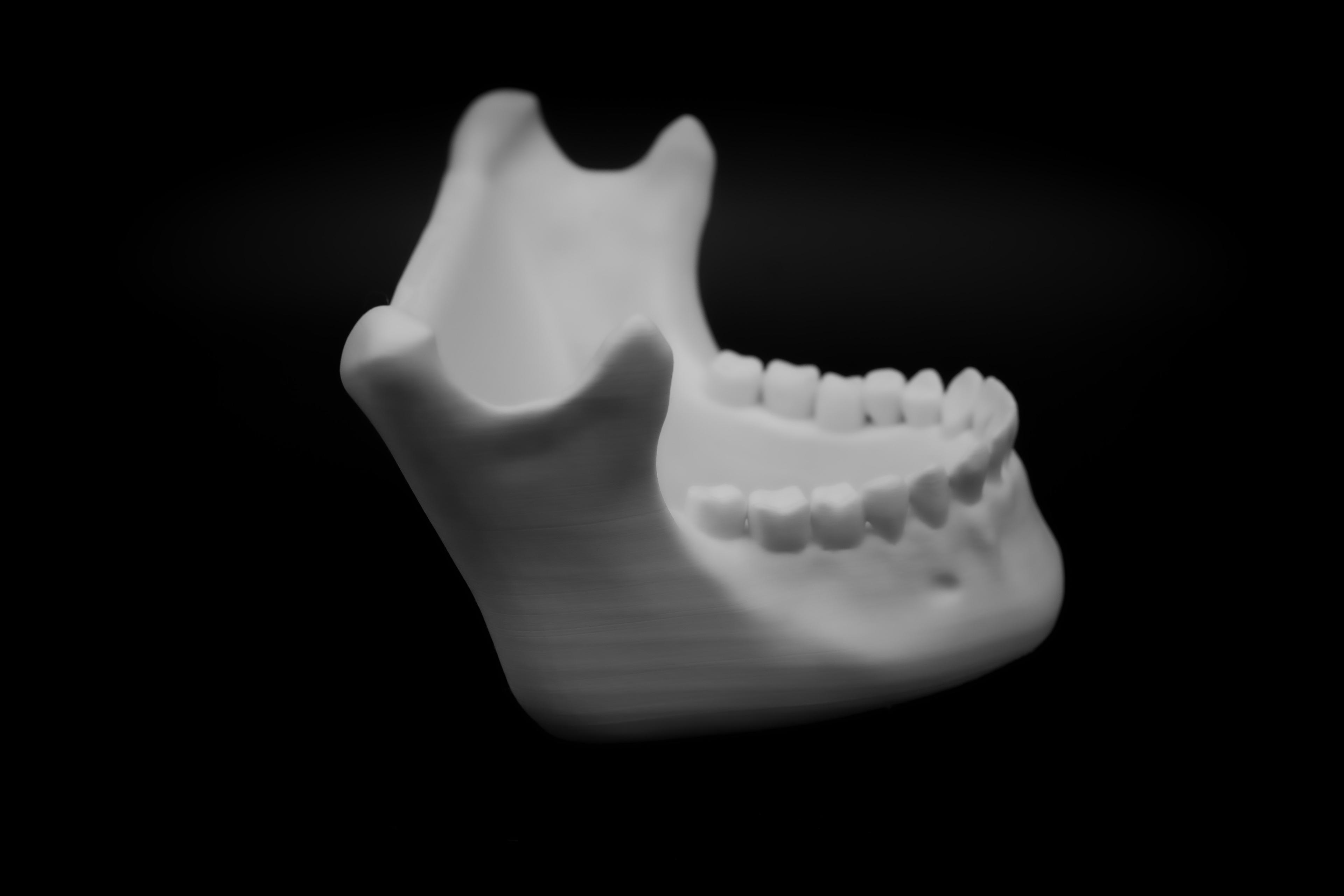 Human Jaw bowl (Pre Supported) 3d model