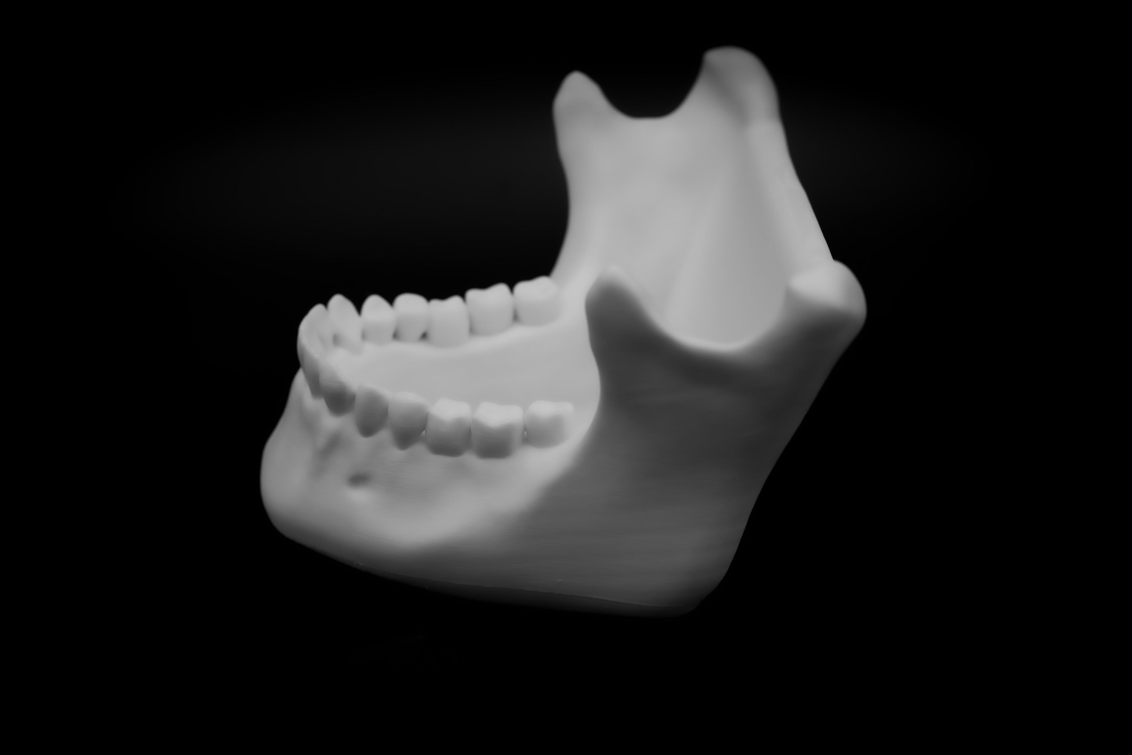 Human Jaw bowl (Pre Supported) 3d model