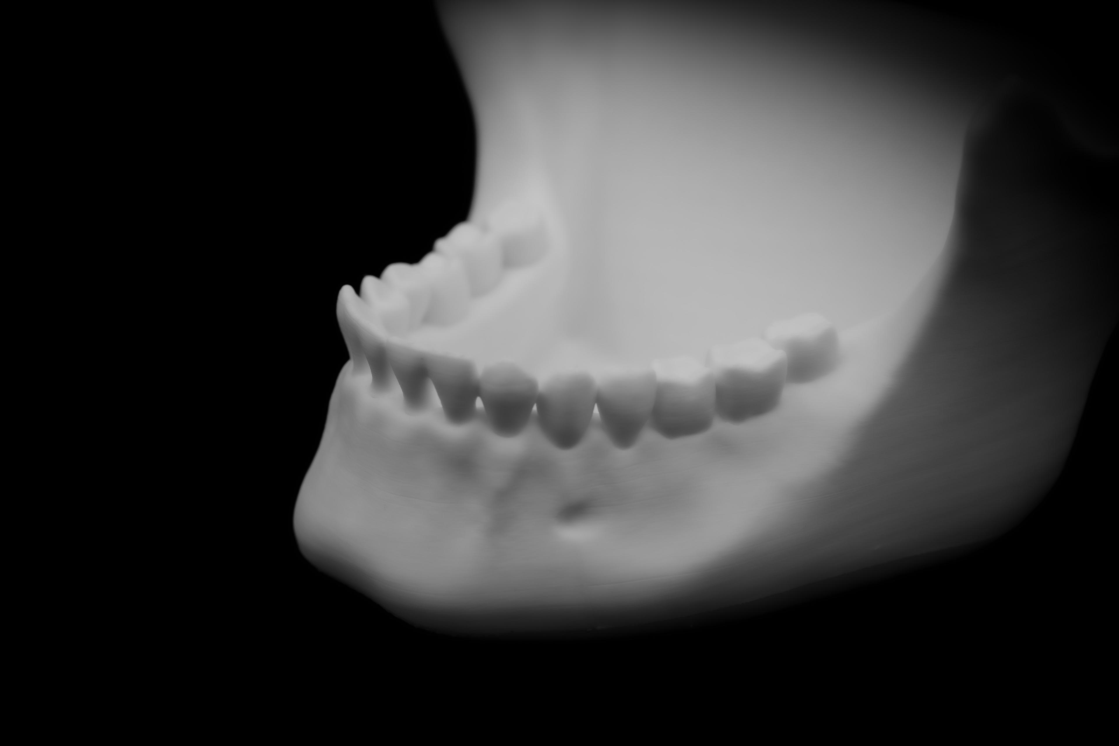 Human Jaw bowl (Pre Supported) 3d model