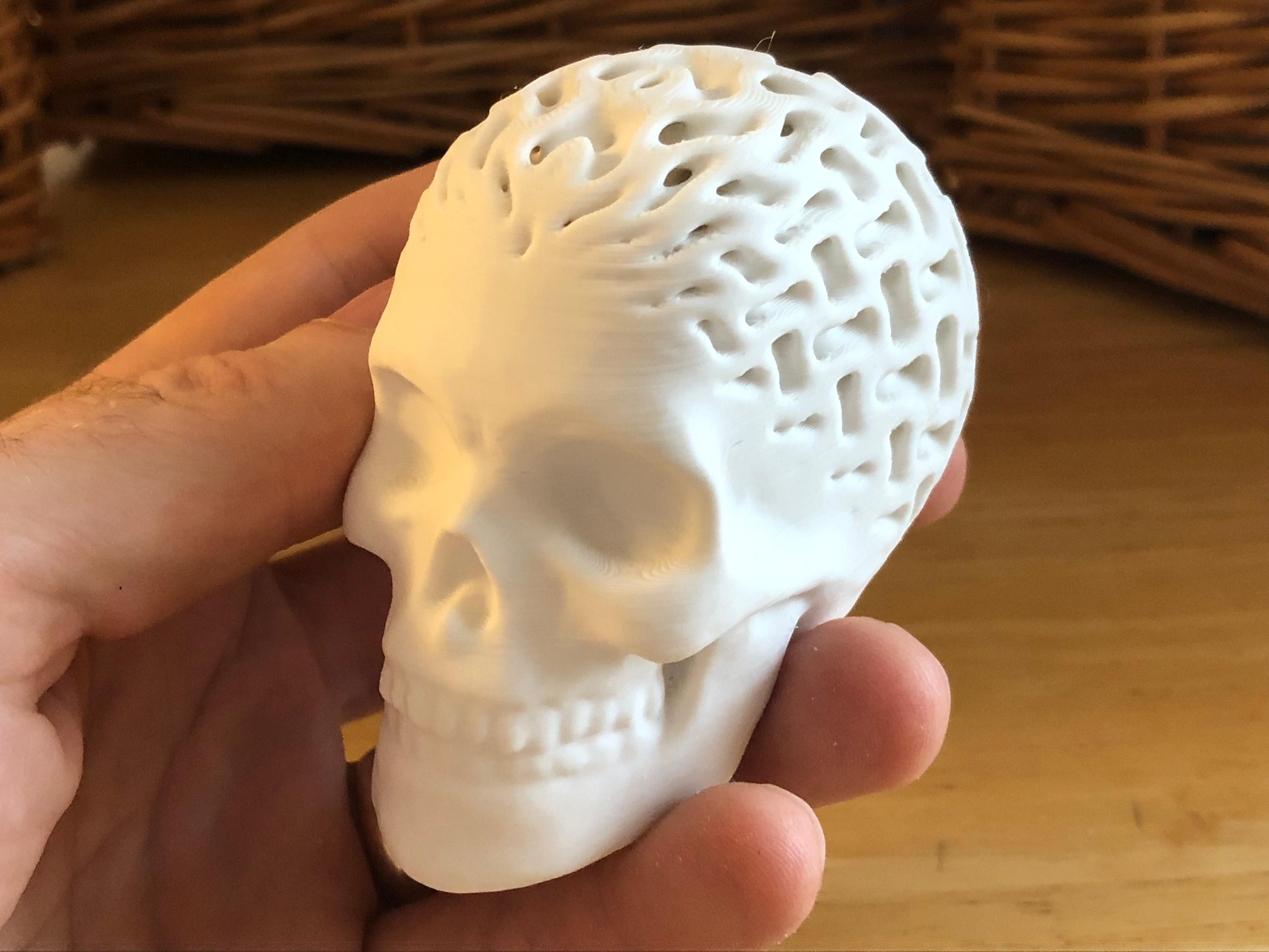 Architected Skull (Gyroid) 3d model