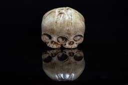 Conjoined Fetal Skull 3d model