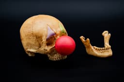 Clown Skull (Rictus) (Pre Supported) 3d model