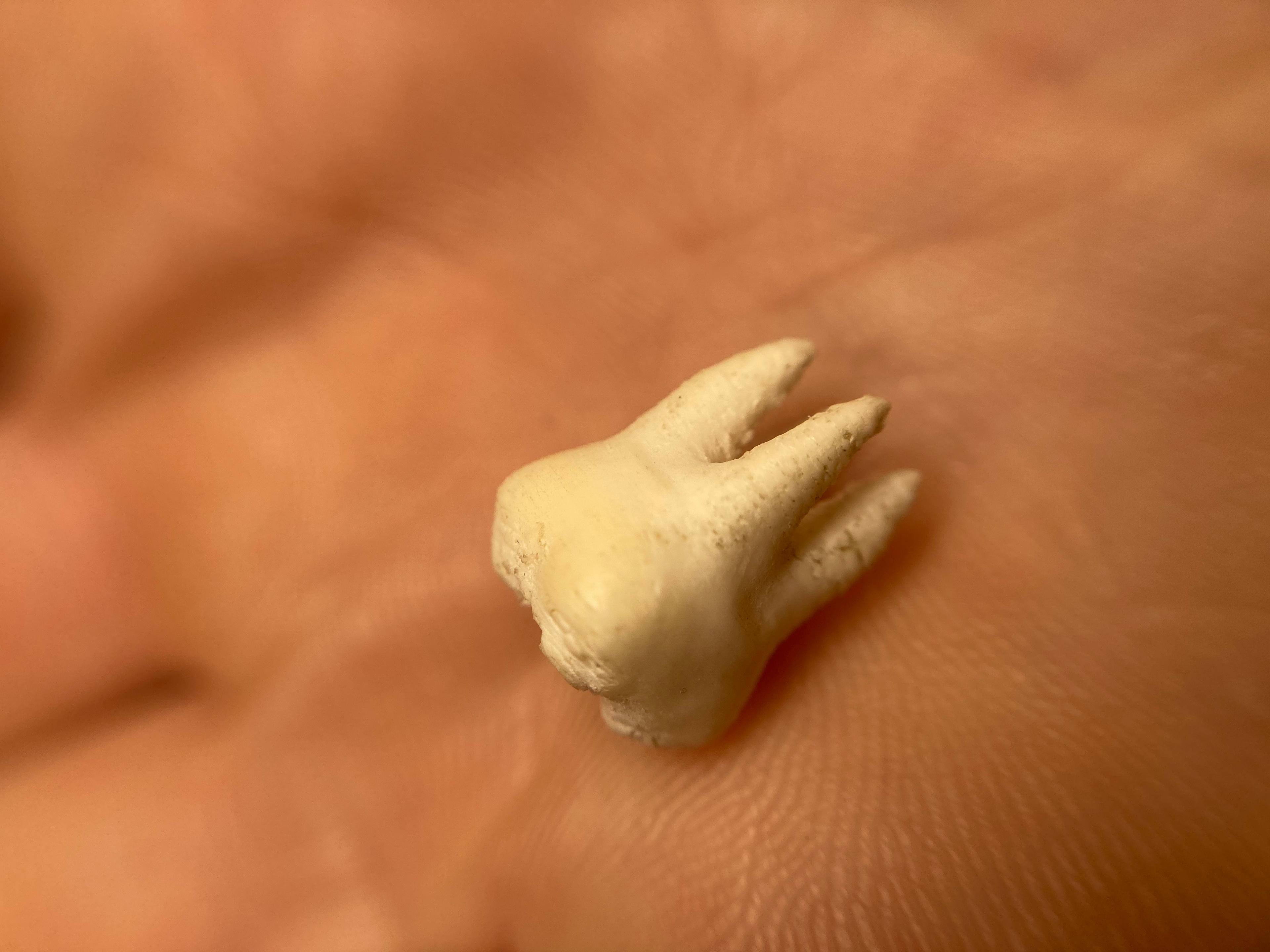 Missing Tooth - *see other* - 3d model