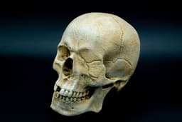 One-Eyed Willy Skull from Goonies 3d model