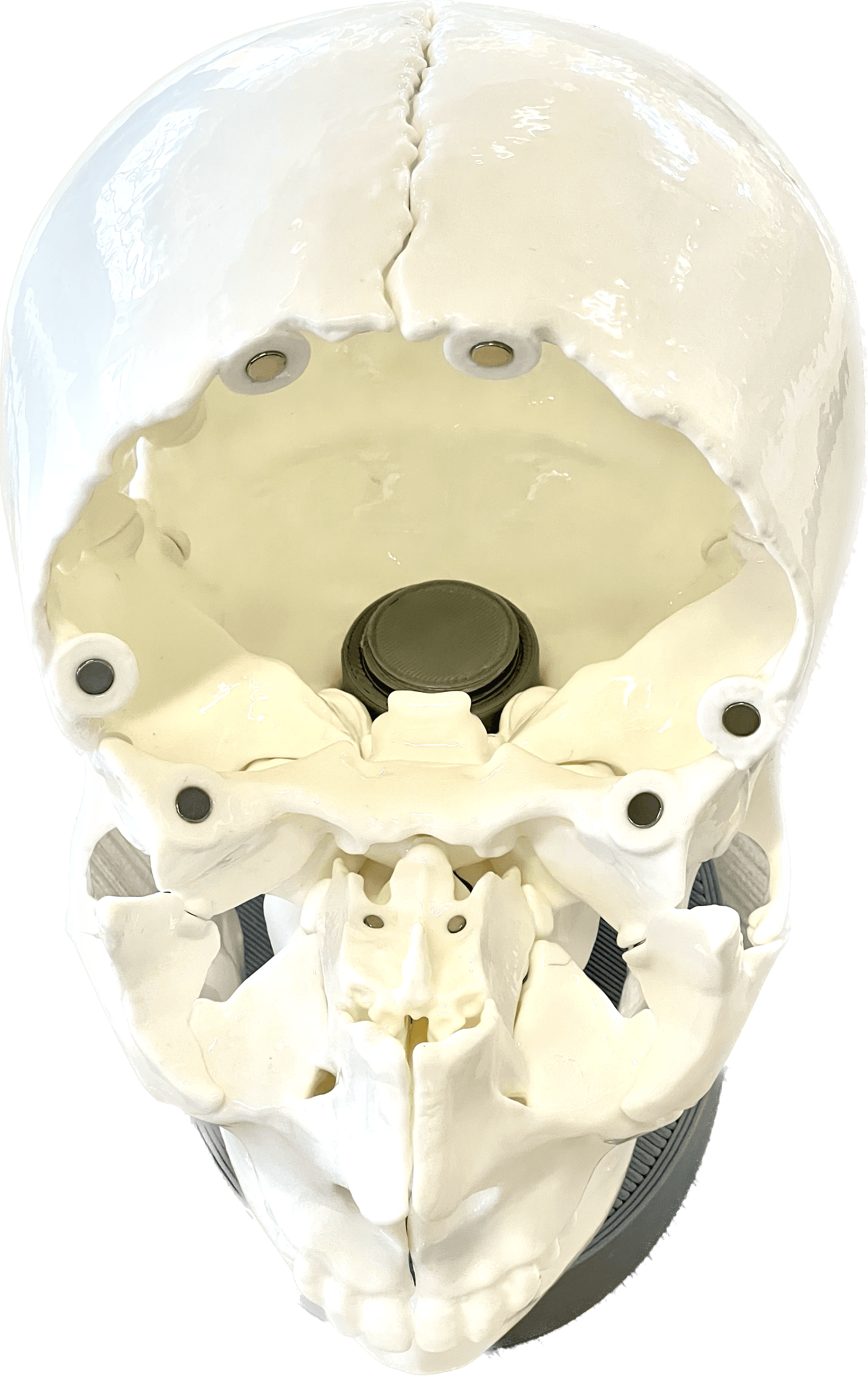 Assembled skull with frontal bone removed
