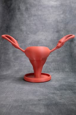 Uterus Pot (Pre Supported) 3d model