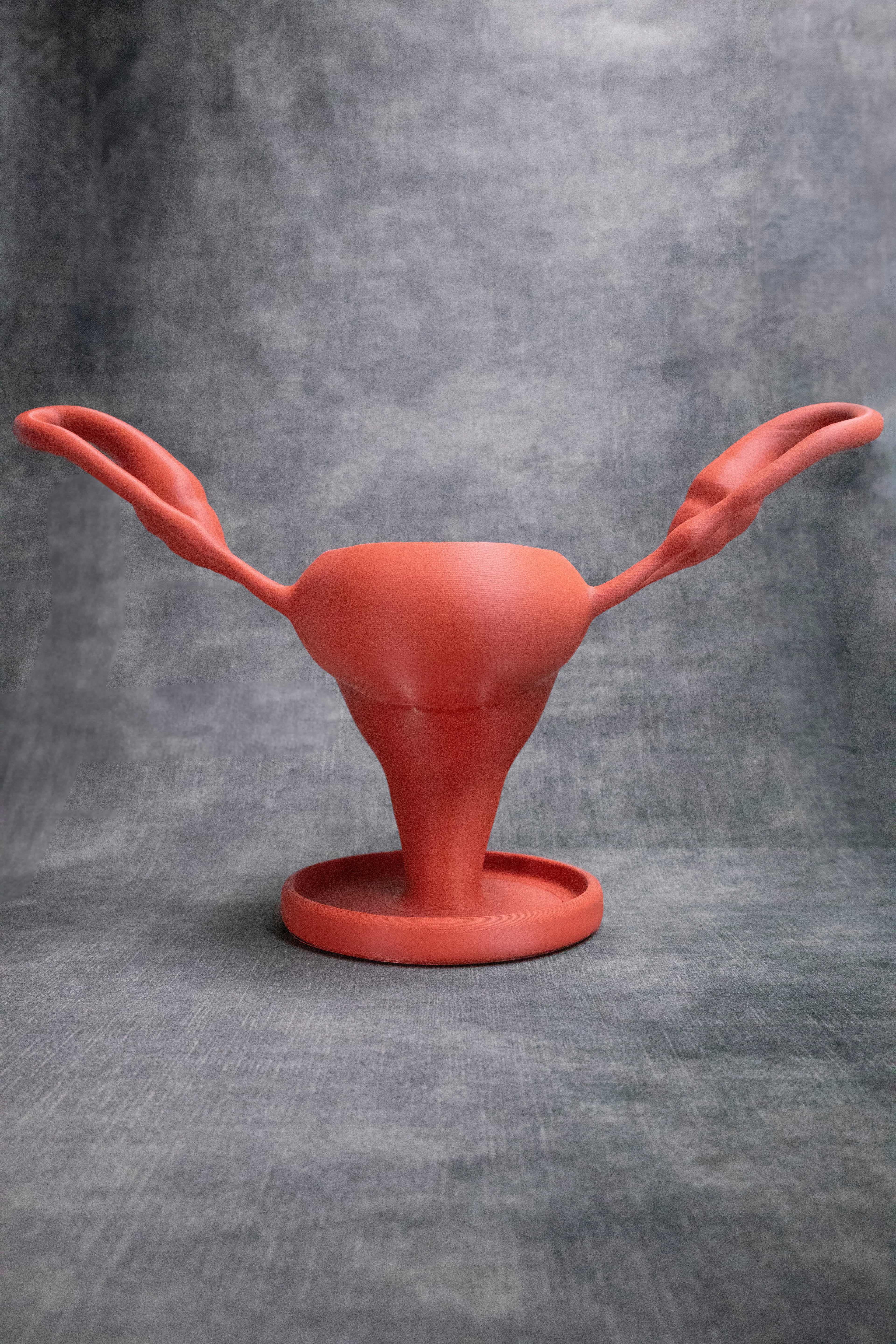 Uterus Pot (Pre Supported) 3d model