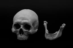 Human Skull (Pre Supported) 3d model