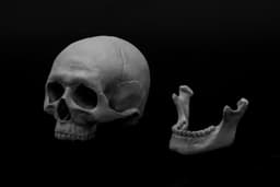 Human Skull (Pre Supported) 3d model