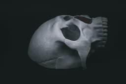 Human Skull Modular (Pre Supported) 3d model