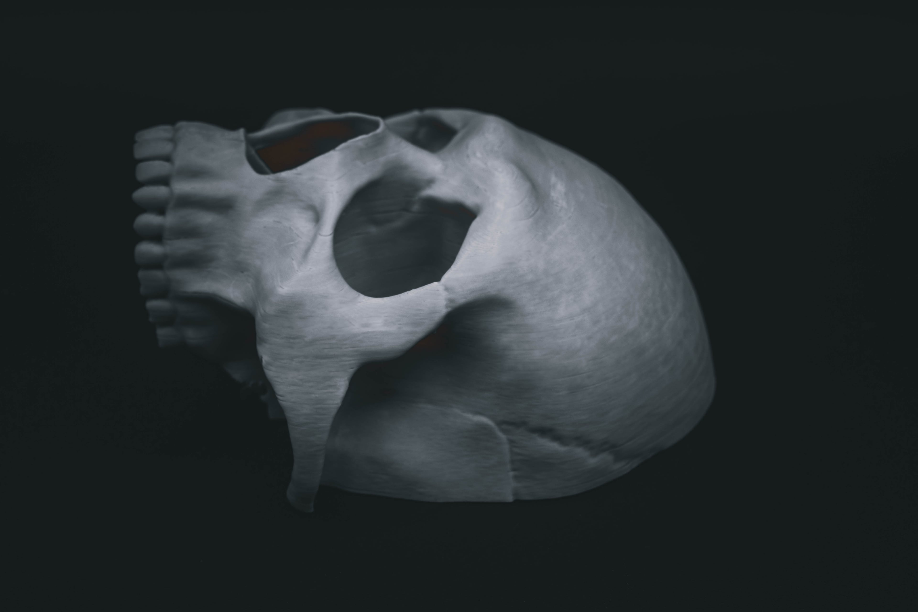 Human Skull Modular (Pre Supported) 3d model