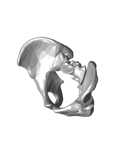 Pericapsular osteotomy 3D print model for clinic 3d model