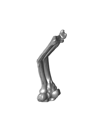 Entire collection of simulated forarm angulated malunions 3d model
