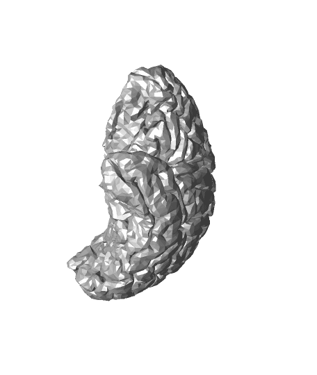 Brain with ALS 3d model