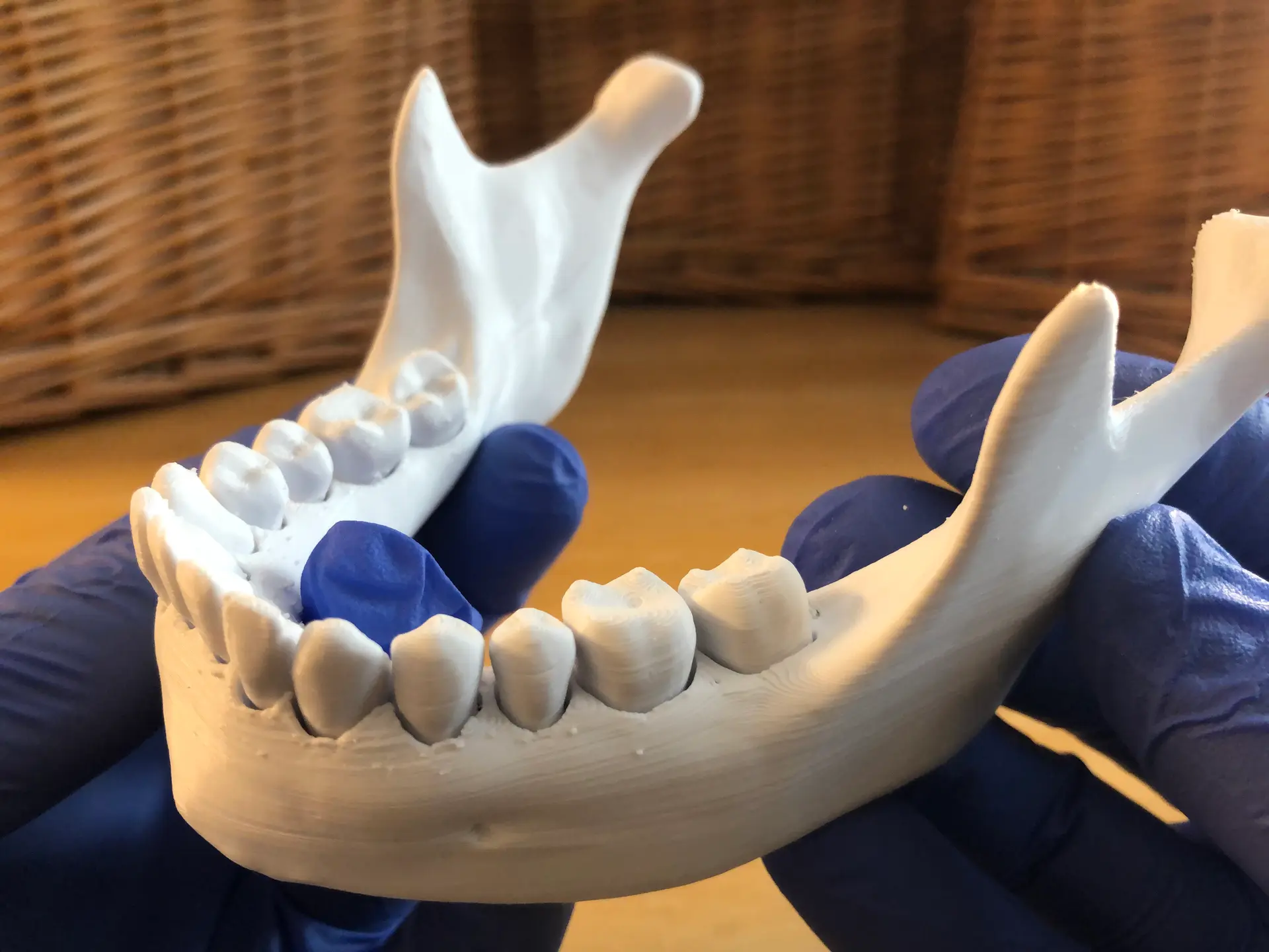 Modeling Teeth Loose Teeth - 3D model by DaveMakesStuff on Thangs