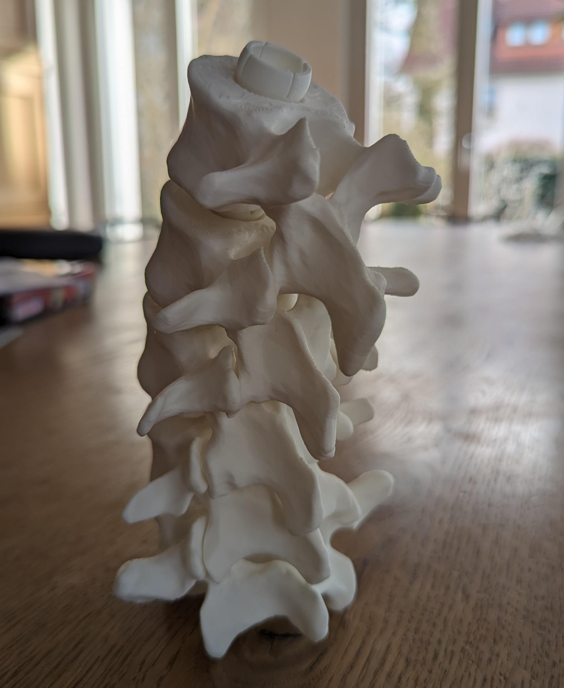 Full-sized Anatomically Correct Articulating Spine - Great model. Fits perfect :)

Prusa MINI+

17,5h  - 3d model